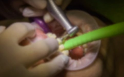 小河马拔牙小班教案